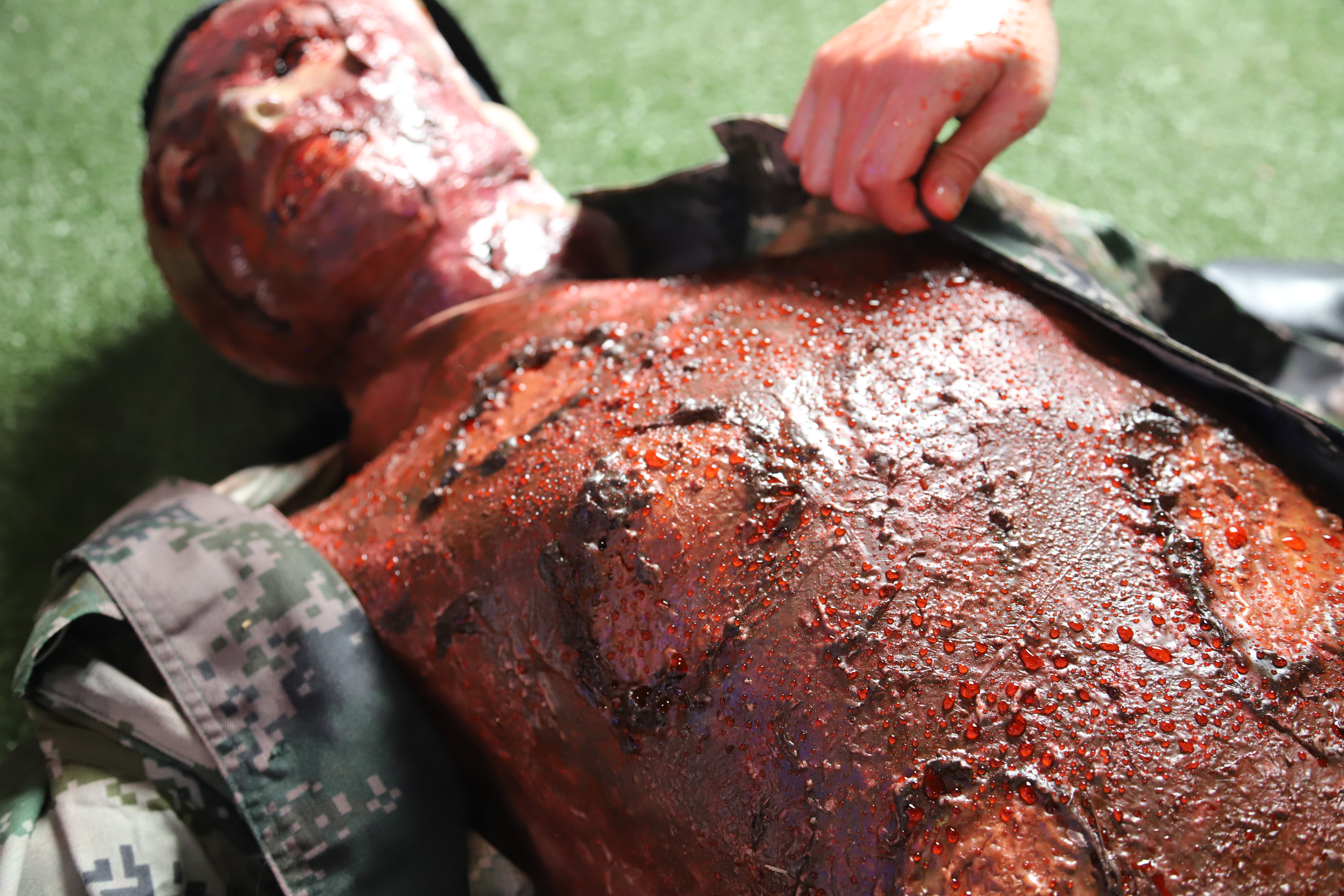 Wearable Burn Wound Kit  